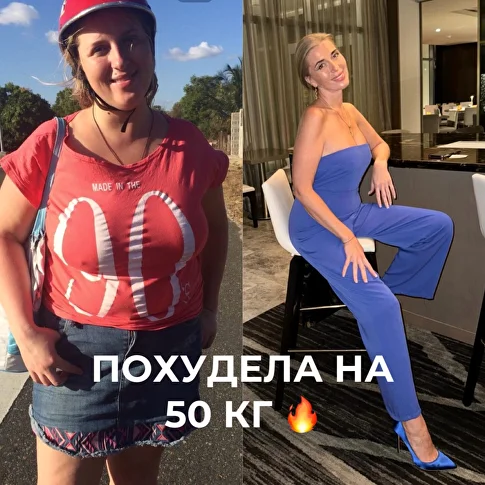 Пациентка похудела на 50 кг